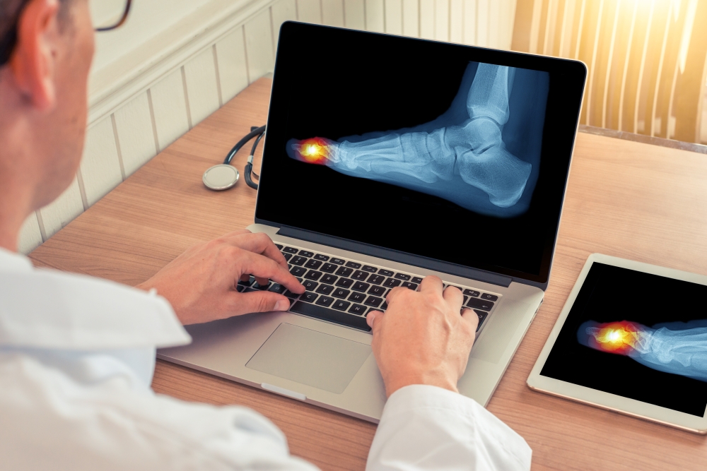 image of a foot x-ray