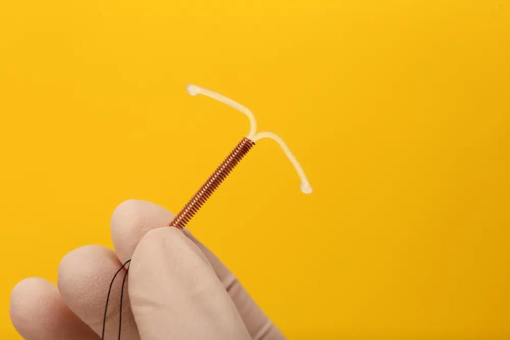 Paragard IUD Controceptive Implant Image