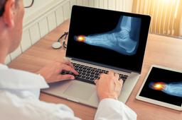 image of a foot x-ray