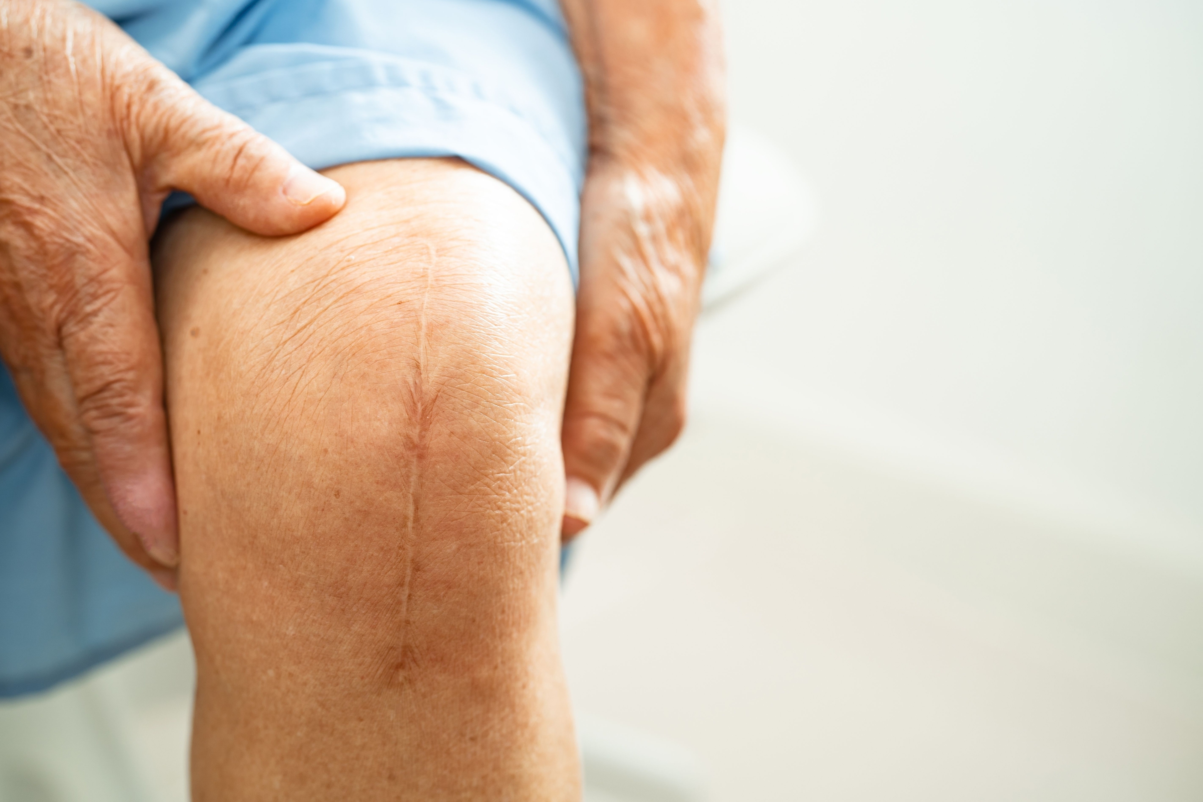 Exactech Knee Replacement Lawsuit