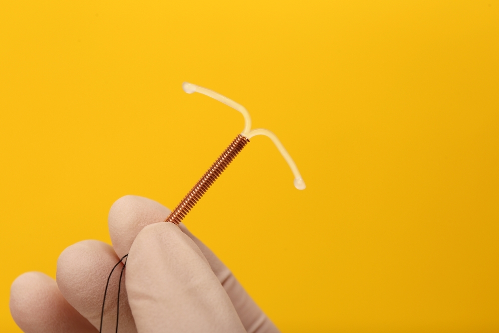 Paragard IUD Controceptive Implant Image